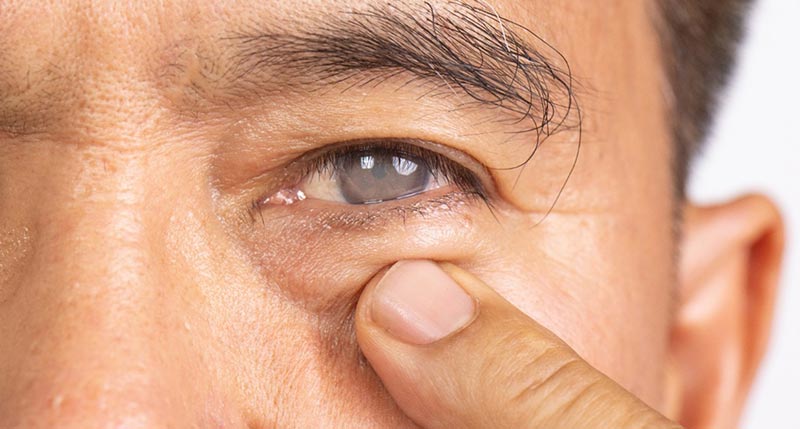 cataract adult pediatric eyecare local eye doctor near you.jpg